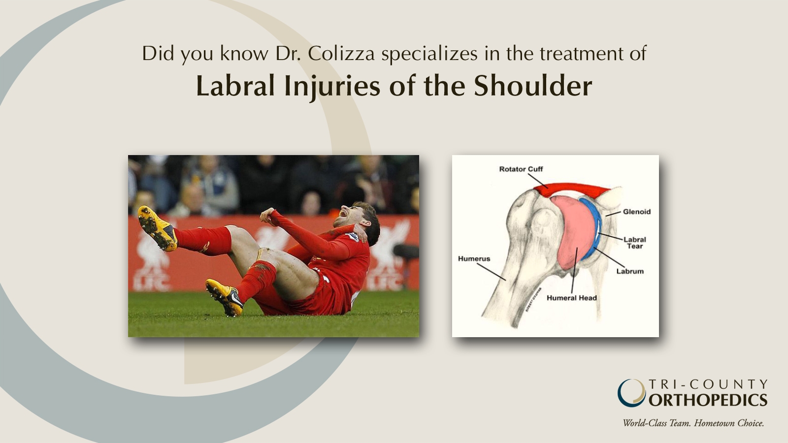 Colizza labral shoulder tri county orthopedics